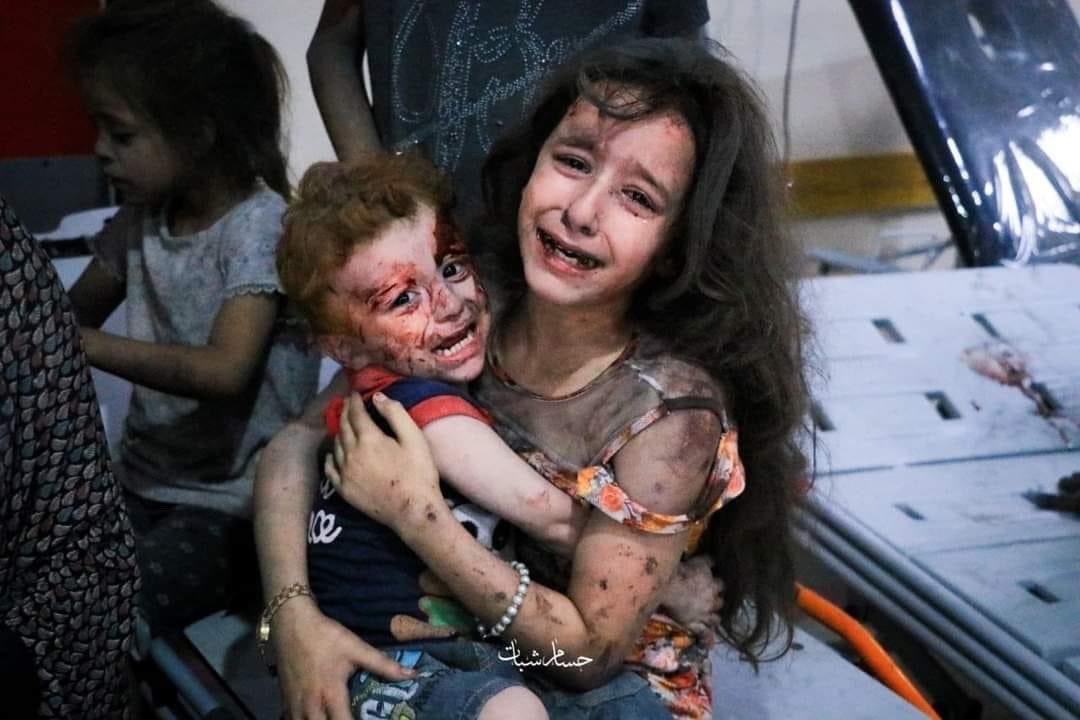 الشهداء انتم  والمصابين نحن 💔