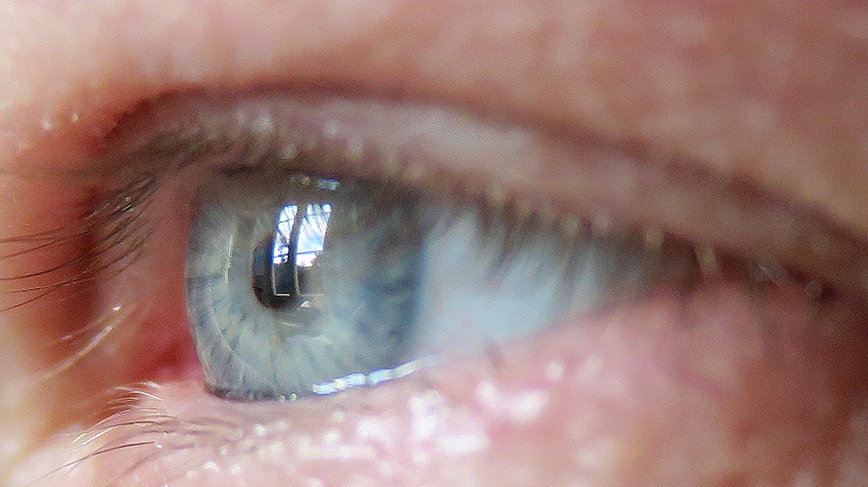 KTHuniversity's tweet photo. Forskare vid KTH och KI har utvecklat ett medicinskt chip som kan implanteras i det mänskliga ögat. Tekniken ger nya möjligheter för behandling av diabetes. https://t.co/JvP15Xou2v https://t.co/M97uDrZGq6