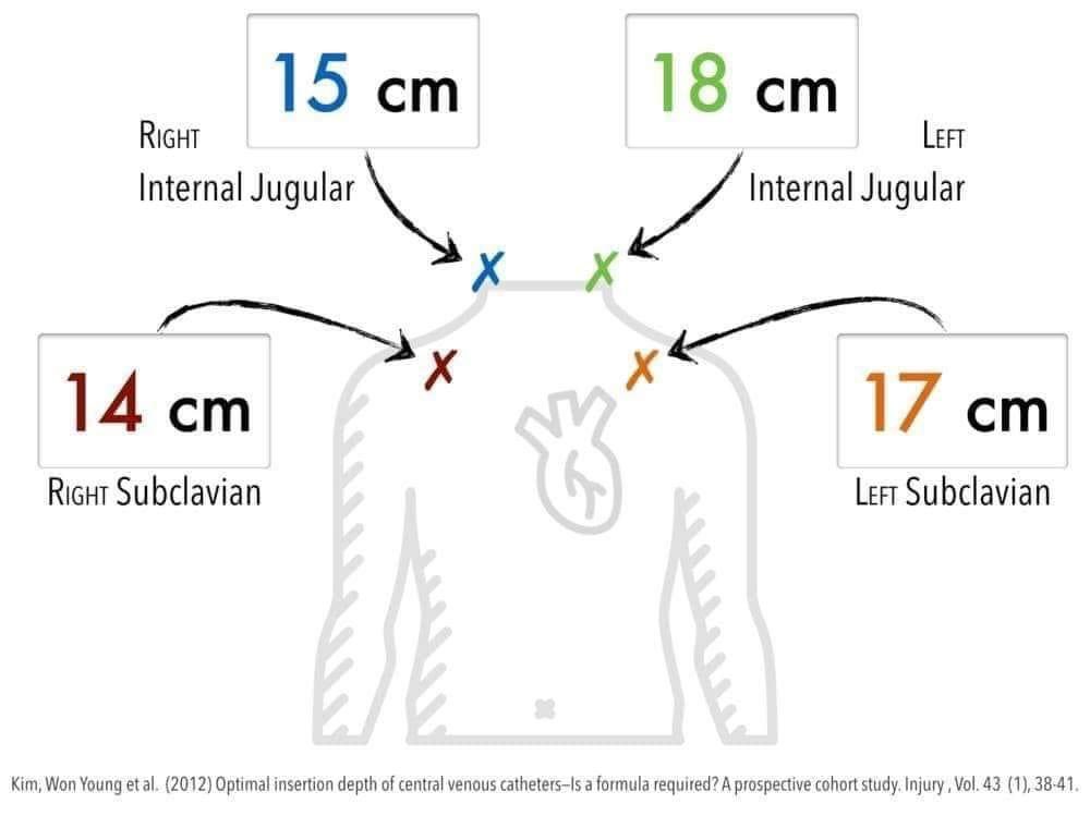 hamood578's tweet image. #معلومه #ernursing 
لاختيار مقاس ال central venous catheters للاطفال والقاعده المتبعه في طول القسطره