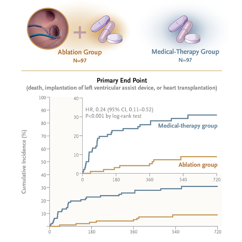 NEJM's tweet photo. In patients with symptomatic atrial fibrillation and end-stage heart failure who are referred for heart transplantation evaluation, the role of left atrial catheter ablation is unknown. 

Full CASTLE HTx trial Research Summary by Dr. @chris_sohns et al: https://t.co/g0Hjnqp6eQ
