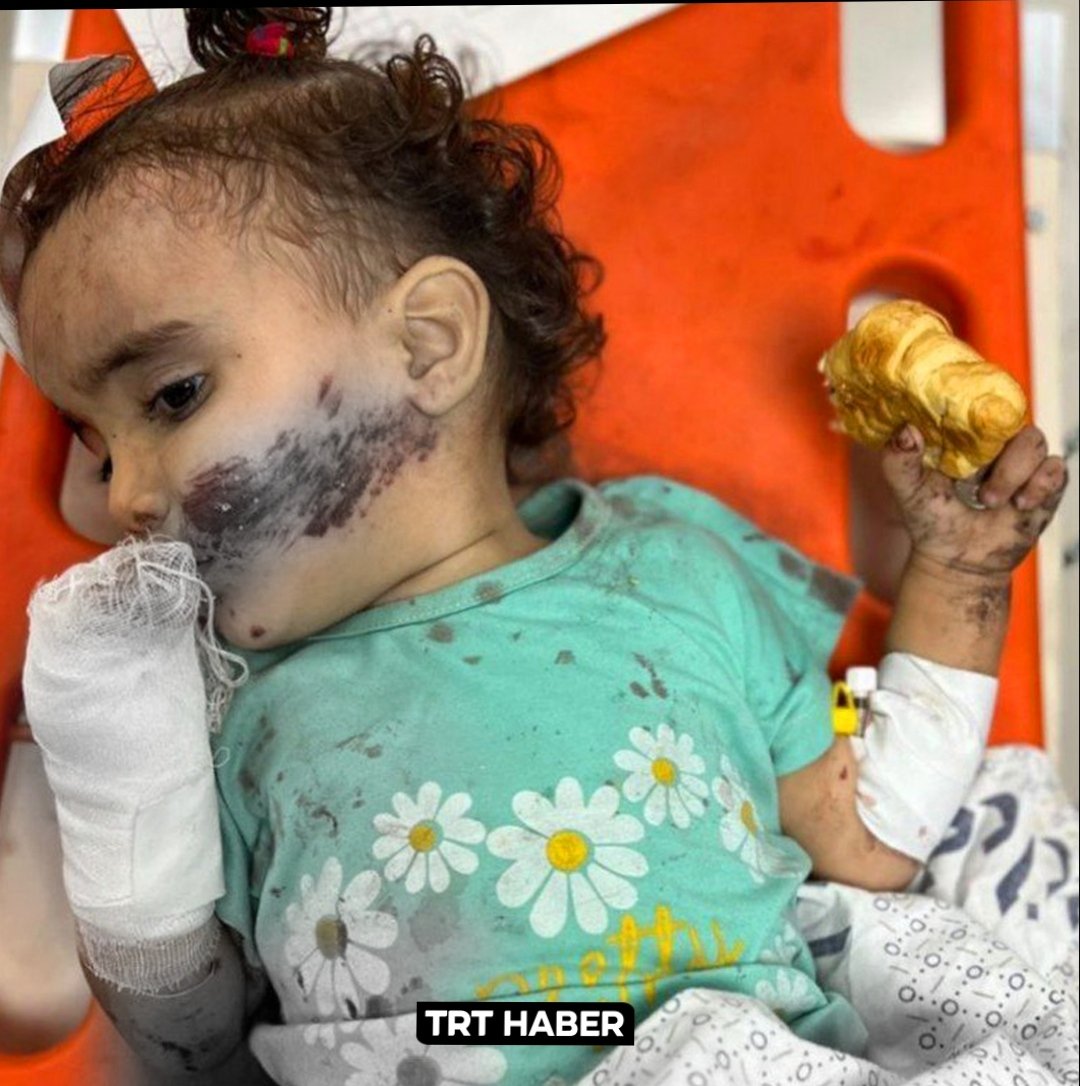 Müslümanlar;
Batı'ya sempati duymaktan, mazlumlara empati kuramaz hale gelmiştir...

#hospital #FreePalastine #FreeGaza #ISRAIL_A_TERRORIST #ZionistTerror #PalestineGenocide