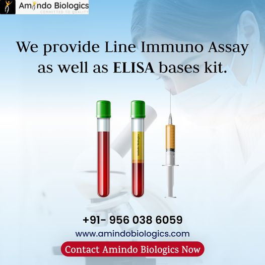 Discover Our Comprehensive Range of Immuno Assay Kits - From Line Immuno Assays to ELISA-Based Kits. Elevate Your Research with Amindo Biologics Today!
 #ImmunoAssays #ELISAKits #Biotechnology #AmindoBiologics #ELISATestKits #Diagnostics #Biotechnology #MedicalTesting