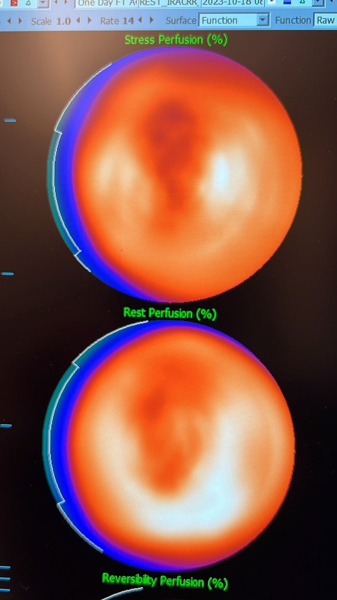 Is there anything more beautiful than this?
#CardioTwitter #CardioEd
