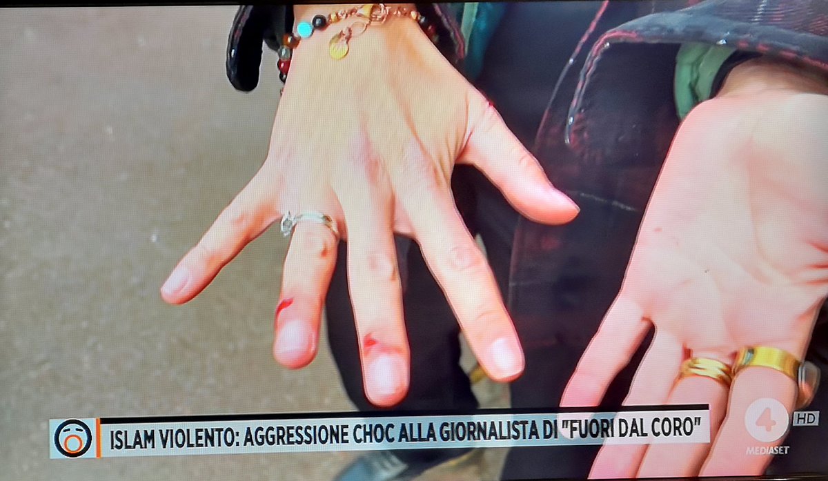 Silvio_Did's tweet photo. La polizia francese:
"È zona loro, se tu avessi avuto il velo molto probabilmente tutto questo non sarebbe successo"... Ma stiamo scherzando!!! Loro?!! 

#fuoridalcoro
@mariogiordano5 https://t.co/7PVRHi3zzk