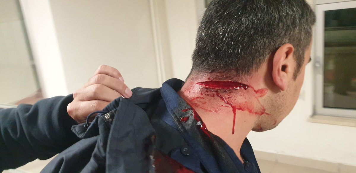 ikomder's tweet photo. Ne zamana kadar SUSACAKSINIZ!

Saldırıya uğrayan meslektaşımıza geçmiş olsun dileklerimizi iletiyoruz.

İnfaz ve Koruma Memurları kapalı alanlarda, suça bulaşmış kişilerin infazını yattığı yer olan 
Ceza İnfaz Kurumlarında çalışmaktadır. Hiç bir mahkûm cami avlusundan alınıp Cezaevine gelmiyor.

İnfaz ve Koruma Memurları her gün psikolojik ve fiziksel saldırılara maruz kaldığı gibi sürekli tehdit ve hakeretlere de maruz kalmaktadır.
Bu durum bizler için psikolojik olarak yıpratıcı olmaktadır.

Tüm bu olumsuzluklarla beraber amirlerimiz tarafından uğradığımız mobbingler, aldığımız düşük maaş, özlük haklarımızda ki yetersizlikler, sahipsiz oluşumuz ise bizleri içerisinden çıkılmaz düşüncelere sokmaktadır.

Bizler Kahraman İnfaz Korumalarız ve sorunlarımızın bir an önce bekletilmeden çözülmesini ve sesimizin duyulmasını bekliyoruz.

#İnfazKorumayaYapılanlarYeter