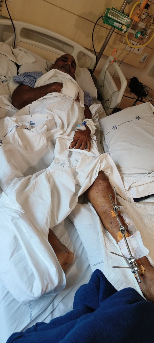 Upenupadhyay143's tweet photo. Retired senior citizen harassed and brutely beaten, Fatal injuries, No arrest made yet, fear of life, no guarantee of common man life.
Need help from UpGov. UpPolic
@upcmoffice 
@dgpup
@chiefSecyup
@homeupgov
@JaunpurSp @jaunpurpolice https://t.co/DfQloS46UV
