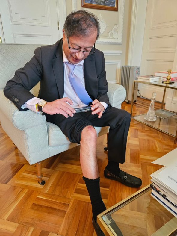 SaVanessCa's tweet photo. Todo zurdo es vago y flojo, que hijueputa karma estamos pagando con este inútil? https://t.co/XPBRueilF2