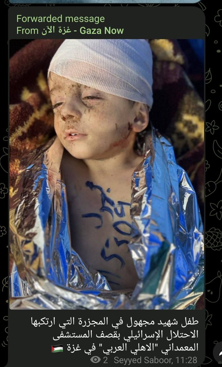 Dr_Zolfaa's tweet photo. في لحظة واحدة 800 شهيد .. تخيل
 فقط أنك جريح ونازح ولا مكان آمن لديك
 غير تلك الزاوية من المستشفى ويصبج ذلك
 الأمان رعبا في لحظة واحدة !! 

بعد الآن من يقول دعك عن قضية #فلسطين
 تأكد انه من أسفل السافلين وقد سلب الله 
منه الرحمة والتوفيق .

 #غزه_تستغيث https://t.co/drHIV2SVg6