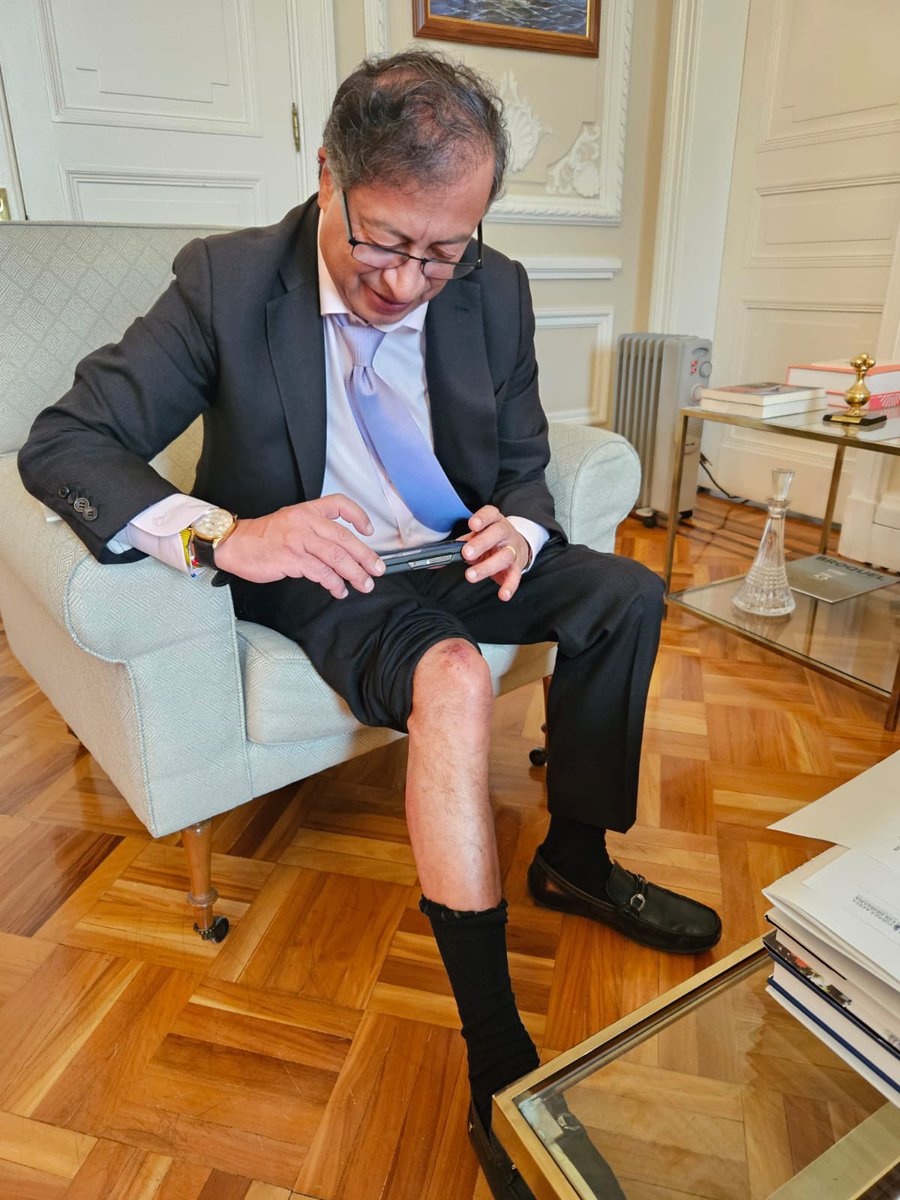 Uribe cuando se cayó de un caballo a todo galope.
                            //
Petro cuando se raspó la rodilla