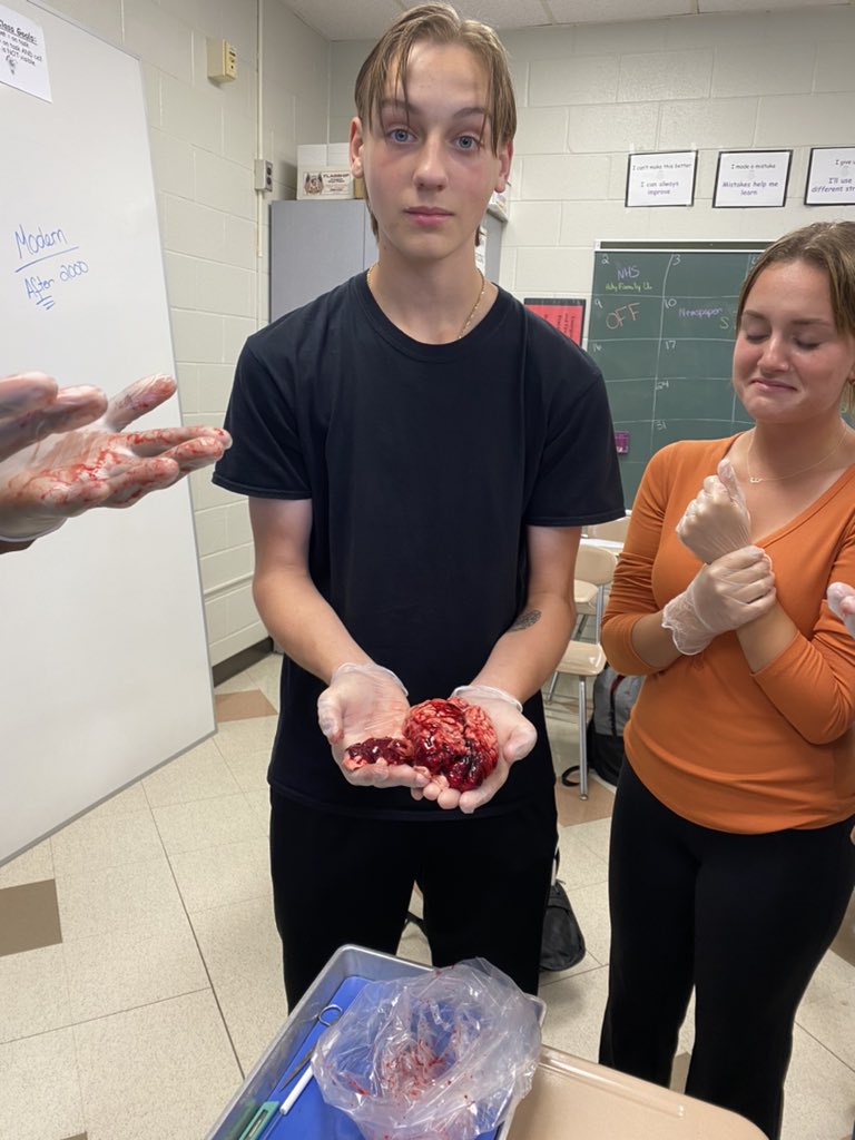 mrsfranchetti's tweet photo. Using a real COW BRAIN to help understand how the human brain works! #APpsychology @overbrookrams https://t.co/5pxpoTIkBU