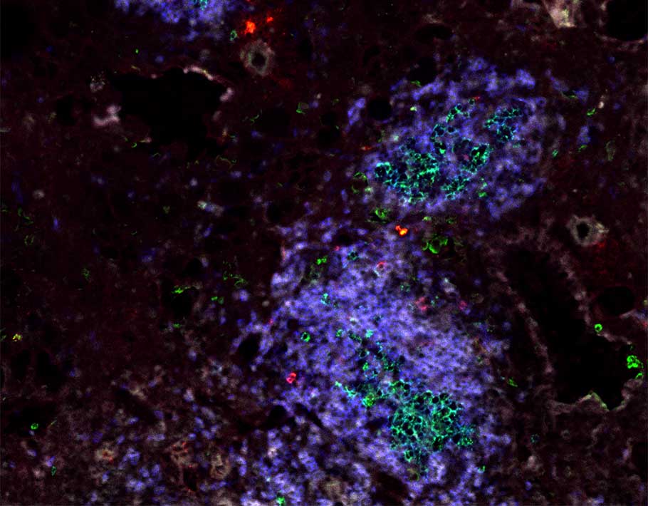 Flu season is approaching—to prepare, learn how after #influenza infection, a resident memory B cell population remains in mouse and human lung tissue to support responses to the next infection. scim.ag/4vl <a href="/SciImmunology/">Science Immunology</a>