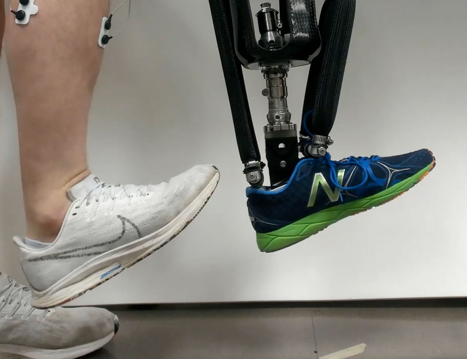 An electromyographic #EMG-controlled ankle #robotic #prosthesis helps achieve postural stability in lower limb amputees. @jointbme Read more in Science #Robotics: scim.ag/4vo