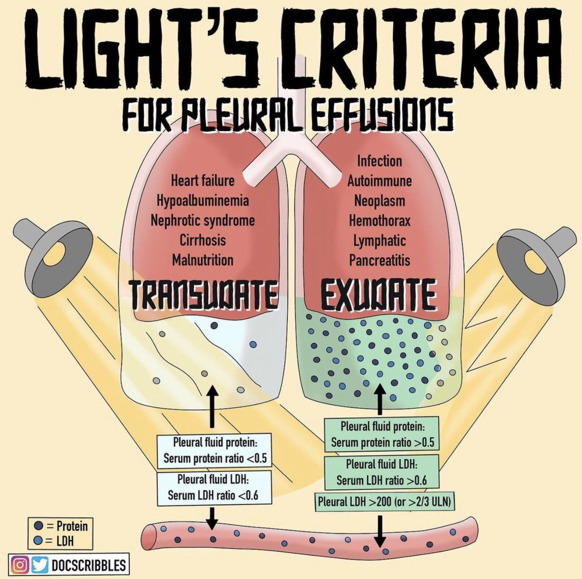 Light’s criteria عشان م تنساها تذكر انه يهمني LDH and Protein والاثنين يكونو ب Exudate In pleural space more than in serum يبقى تحفظو الارقام بسس