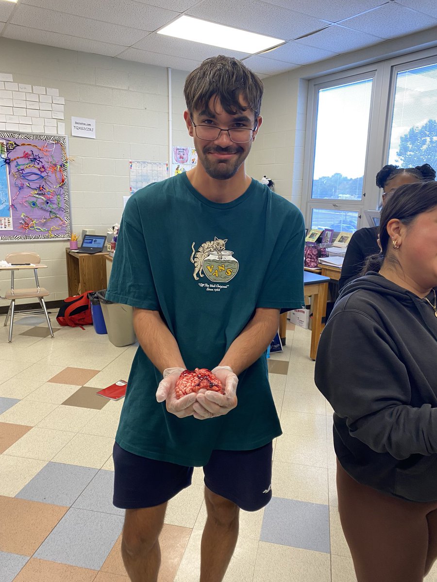 mrsfranchetti's tweet photo. Using a real COW BRAIN to help understand how the human brain works! #APpsychology @overbrookrams https://t.co/5IDFPamWkS