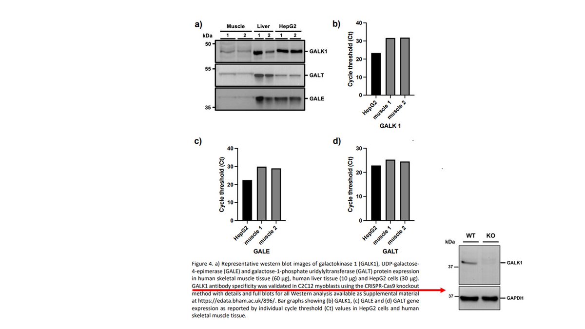 gareth_wallis's tweet photo. Lots of questions here around if the circulating galactose is/was used for glycogen synthesis. We don't have the answers. Our exploratory analysis by @alex_seabright @SamLord98 and @RitaCivil saw human skeletal muscle expresses Leloir pathway enzymes at gene and protein level 6/7 https://t.co/7Doqrv5sQi