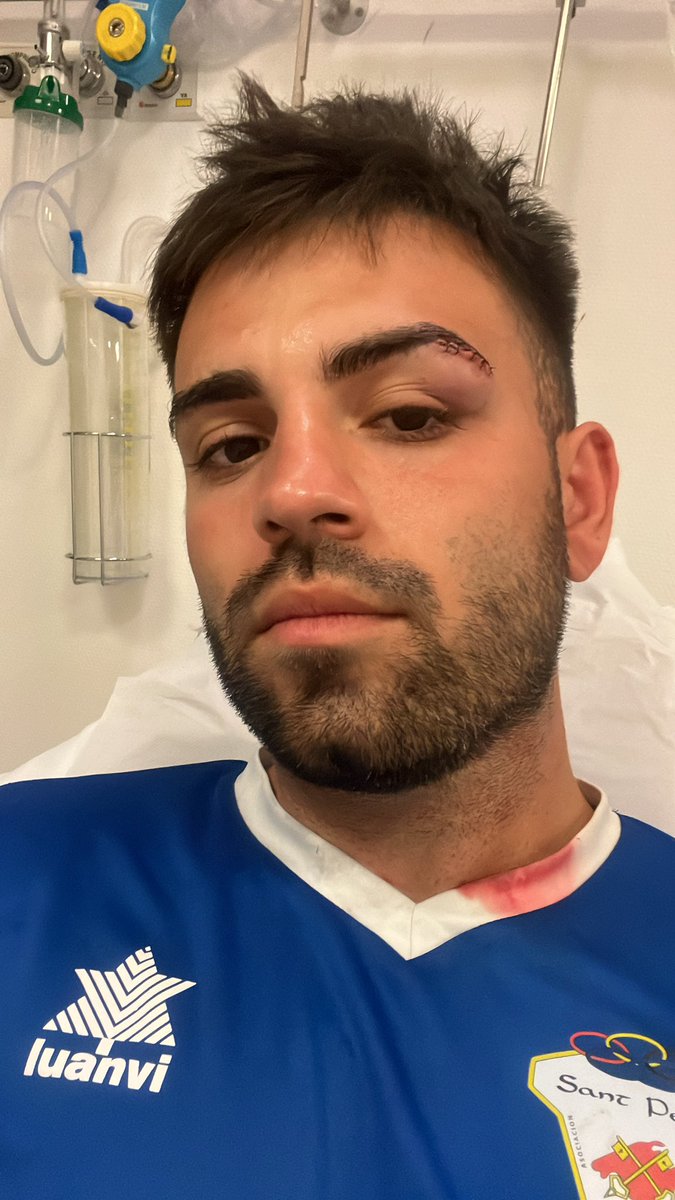 daniel8sastre's tweet photo. Dicho jugador del Arta siguió increpándome, hasta que una persona de su cuerpo técnico salió al campo para separarlo, tuvieron que asistir los servicios sanitarios debido a los mareos, vomitos y una brecha en la ceja donde he necesitado 5 puntos… https://t.co/iu8IjcdR6V