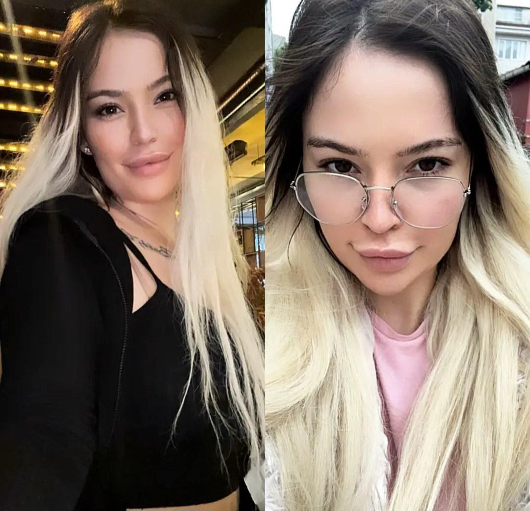 AZRU YILMAZ İYİLİK VARSIN CANIM 🫶🏻❤️ <a href="/arzuylmazzz/">A.Y 🇹🇷</a>