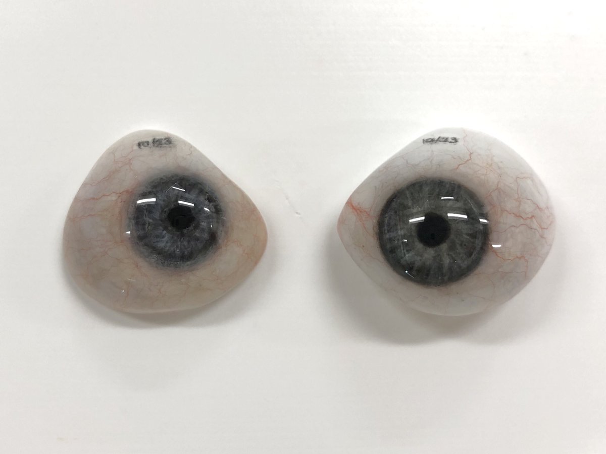 A 10mm diameter vs. 13mm diameter iris (most are between 11-12mm) #ocularistry #prostheticeye