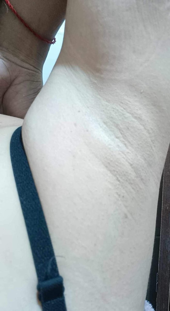 love the armpit (@dragonpinkspink) on Twitter photo 