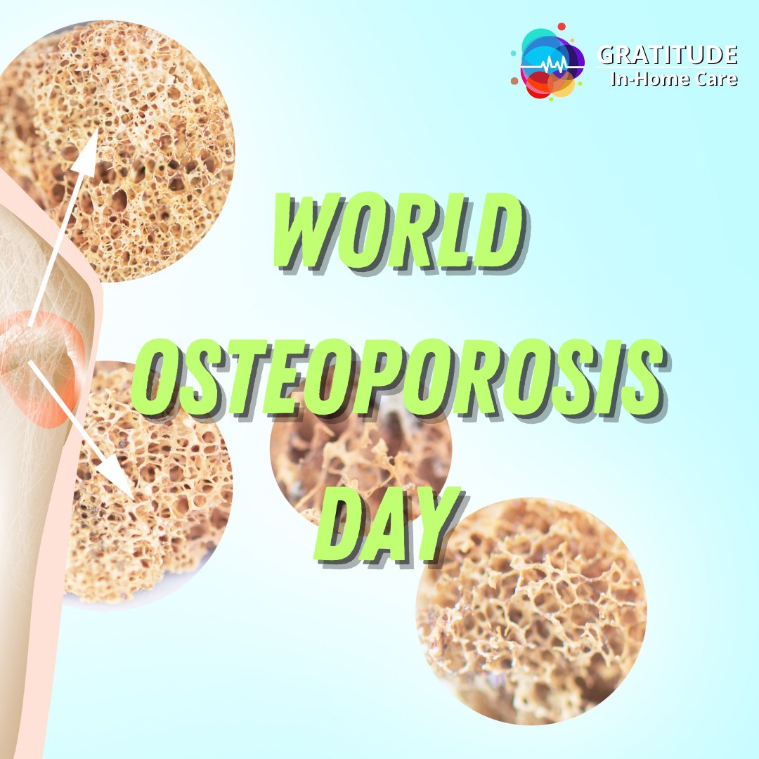 Tomorrow is World Osteoporosis Day

The root of this issue is osteoporosis, a condition that renders bones brittle and fragile, causing them to break from seemingly minor incidents like a stumble, a bump, a sneeze, or a sudden movement.