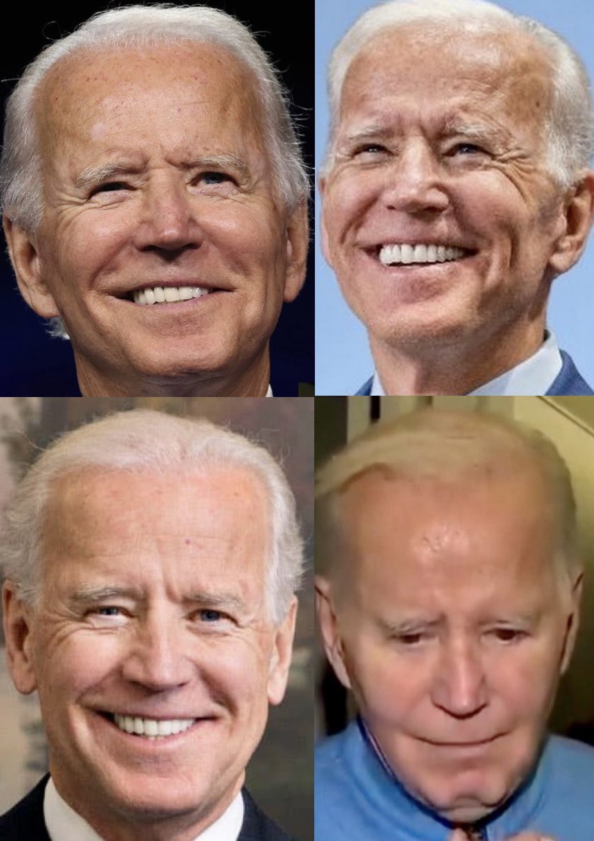 What Happened To Biden'S Chin?