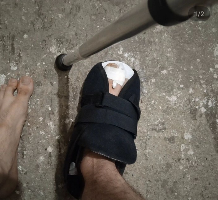 MiguelACaro1886's tweet photo. #RodillaChallenge es mi pie derecho fracturado. A pesar de tener un mes de incapacidad médica, me tocó trabajar desde la casa mandando informes.
Aún no me recupero bien y hoy estuve haciendo mi trabajo de funcionario público y el otro hpta se queja por un raspón. https://t.co/1x2RgOnFkJ