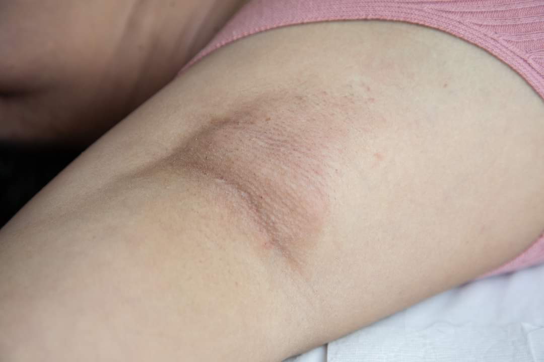 love the armpit (@dragonpinkspink) on Twitter photo 