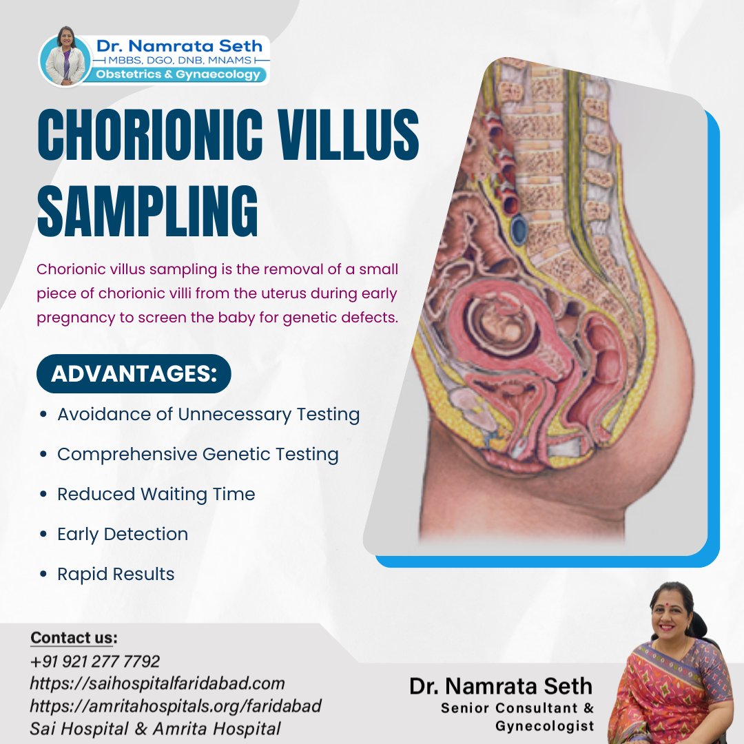 SaiFaridabad's tweet image. #cvs
#chorionicvillussampling
#prenataltesting
#genetictesting
#prenataldiagnosis
#fetalhealth
#maternalhealth
#chromosomeanalysis
#geneticscreening
#chorionicvillussamplingprocedure
#chorionicvillustest
#chorionicvillussamplingtesting
#trendings
#virals
#drnamrataseth
