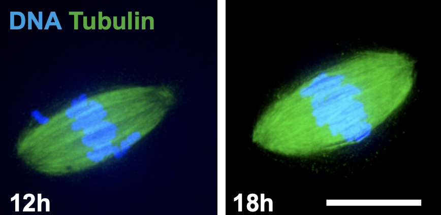 IJMonod's tweet photo. ✍️New preprint from the Wassmann Lab

Everything you always wanted to know about error correction during CSF arrest in oocytes ⬇️

https://t.co/VHsB4gMeY5
©Wassmann Lab https://t.co/raz6e68Tbl