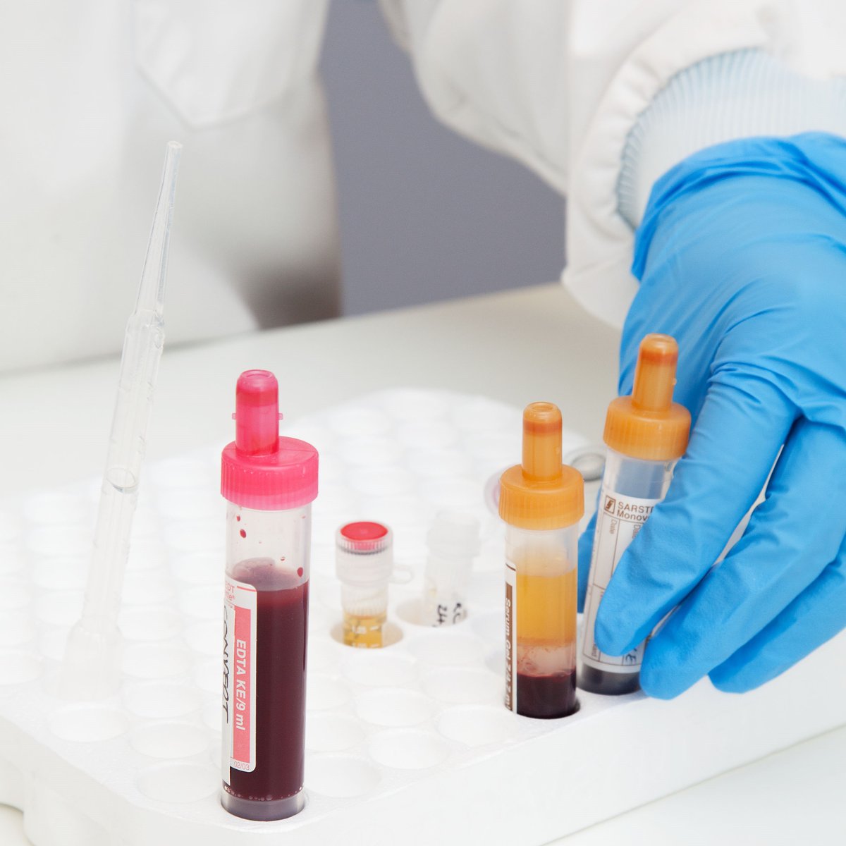 CRUK Cambridge Centre (@crukcamcentre) on Twitter photo NEW JOB! Would you like be involved in translational clinical research aiming to improve early detection and treatment of kidney, bladder and prostate cancer?
We’re looking for a translational research manager to join us <a href="/CRUKCamUrol/">CRUK Cambridge Centre: Urological Malignancies</a>.
Apply by 5 Nov ⬇️
jobs.cam.ac.uk/job/43437/ NEW JOB! Would you like be involved in translational clinical research aiming to improve early detection and treatment of kidney, bladder and prostate cancer?
We’re looking for a translational research manager to join us <a href="/CRUKCamUrol/">CRUK Cambridge Centre: Urological Malignancies</a>.
Apply by 5 Nov ⬇️
jobs.cam.ac.uk/job/43437/