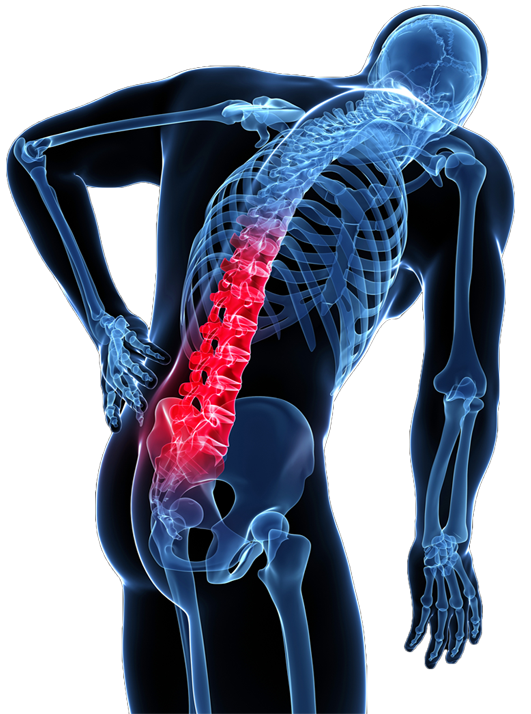 💥Rompiendo Mitos de la #Prevención del Dolor Lumbar💡

Leemos constantemente la importancia de utilizar ayudas ergonómicas y correcciones posturales🙄para prevenir el #dolorlumbar

¿Qué dice exactamente la evidencia?⬇️