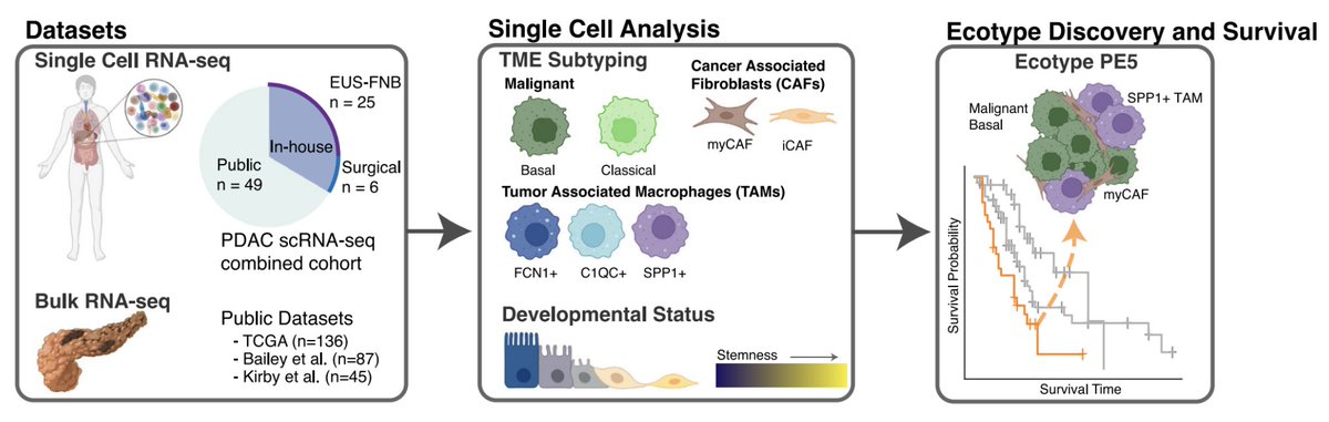 Our new manuscript is out today in <a href="/Nature_NPJ/">npj Journals</a> Precision Oncology  on tumor microenvironment (TME) composition in pancreatic cancer (PDAC)!

nature.com/articles/s4169…

<a href="/abulusmani/">Abul Usmani</a> <a href="/PrathameshChati/">Prathamesh Chati</a> <a href="/aadel_chaudhuri/">Aadel Chaudhuri, MD PhD</a>. Tweetorial below …