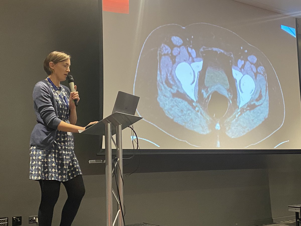 BSER (@bseradiology) on Twitter photo Dr. Helen Oliver ( Consultant Radiologist at <a href="/RUHBath/">RUH Bath 🏥</a> ) kicking off first session post-lunch on Gynae Emergencies at #BSER2023 conference.
<a href="/BathRadiologyEd/">Bath Radiology Education</a> Dr. Helen Oliver ( Consultant Radiologist at <a href="/RUHBath/">RUH Bath 🏥</a> ) kicking off first session post-lunch on Gynae Emergencies at #BSER2023 conference.
<a href="/BathRadiologyEd/">Bath Radiology Education</a>