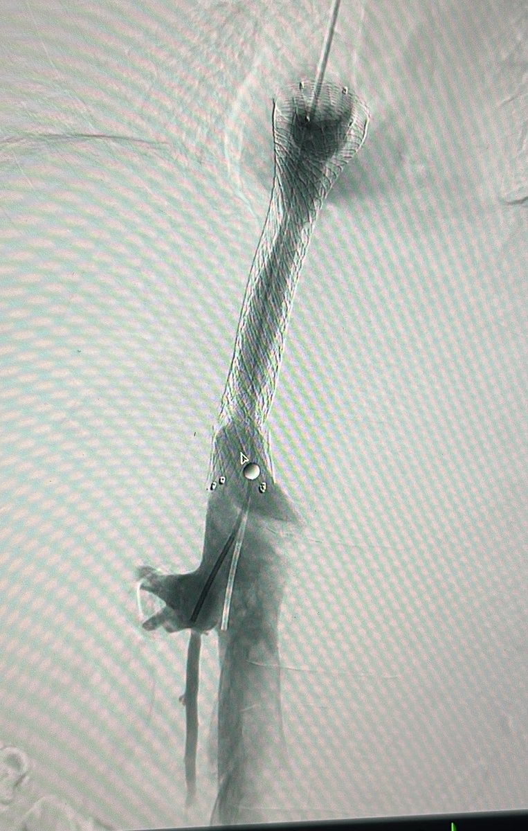 Lenon D'Souza, MD tweet media