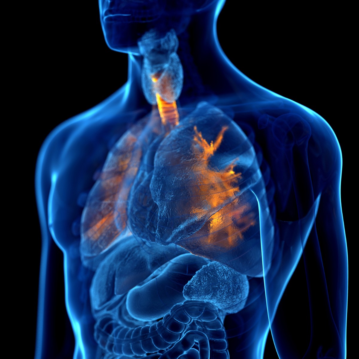 Patients with pulmonary hypertension due to chronic obstructive pulmonary disease (PH-COPD) had increased rates of severe exacerbations, hospitalizations, and costs compared with patients with COPD without PH. Study in <a href="/resmedjournal/">Respiratory Medicine Journal</a>. #pulmtwitter

brnw.ch/21wDFN6