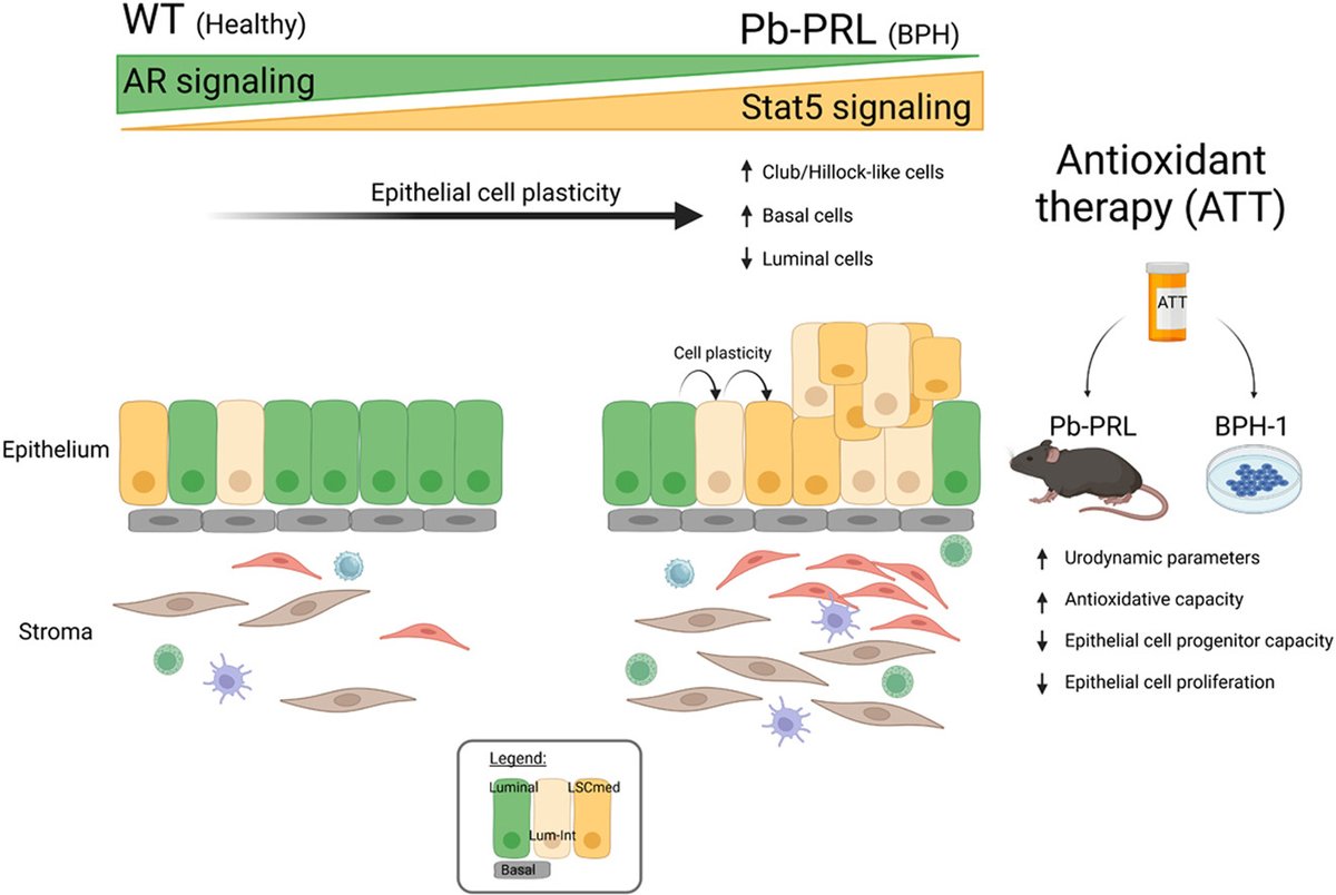 INEM NECKER (@neckerinem) on Twitter photo 🌟NEW PUBLICATION <a href="/AJPathology/">The American Journal of Pathology</a> | New research on Benign Prostate Hyperplasia (BPH): Cell insights from Pb-PRL mouse model, reduced oxidative stress, and promising results with Anethole Trithione. Discover how this could reshape BPH treatment. 🔬
🔗ajp.amjpathol.org/article/S0002-… 🌟NEW PUBLICATION <a href="/AJPathology/">The American Journal of Pathology</a> | New research on Benign Prostate Hyperplasia (BPH): Cell insights from Pb-PRL mouse model, reduced oxidative stress, and promising results with Anethole Trithione. Discover how this could reshape BPH treatment. 🔬
🔗ajp.amjpathol.org/article/S0002-…