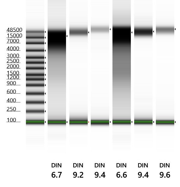 Thidathipw's tweet image. @birdkruasuwan tried selecting &amp;gt;20 kb DNA fragments from #Mycobacterium #tuberculosis gDNA samples using #LightBench by Yourgene Health. We aim to obtain complete genomes of multiple MTB lineages found in #Thailand in a single #nanopore flow cell.