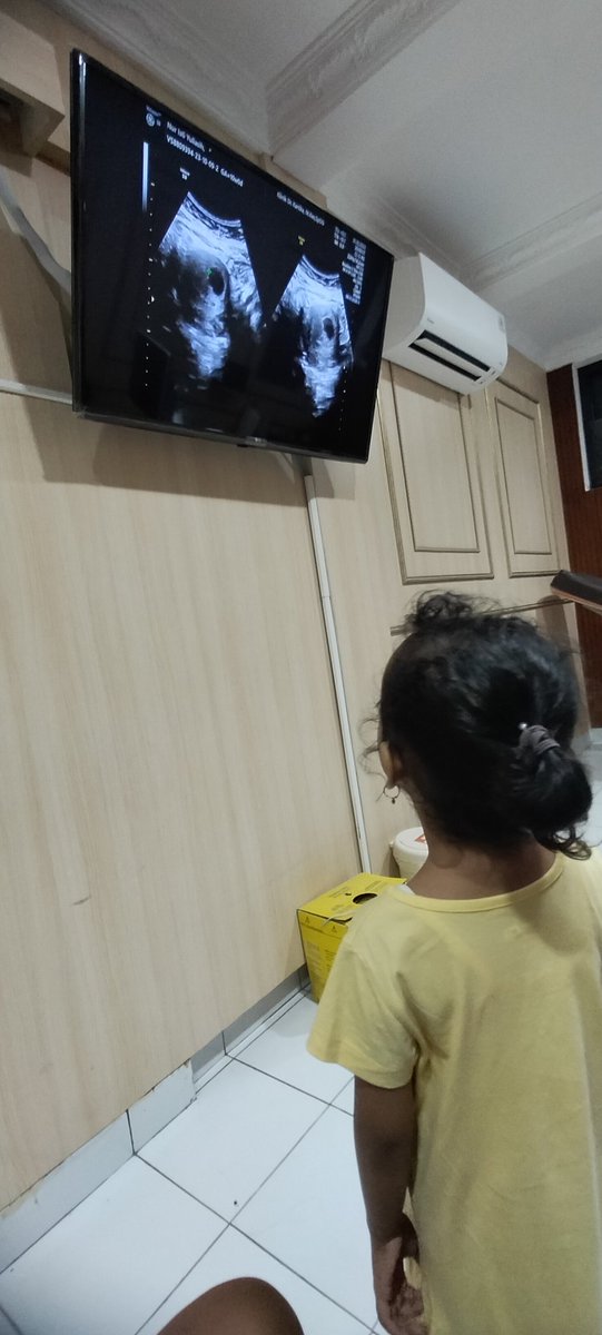 hal yang paling menyedihkan adalah disetiap pertemuan pasti akan ada perpisahan, terimakasih sempat hadir walaupun hanya sebentar.