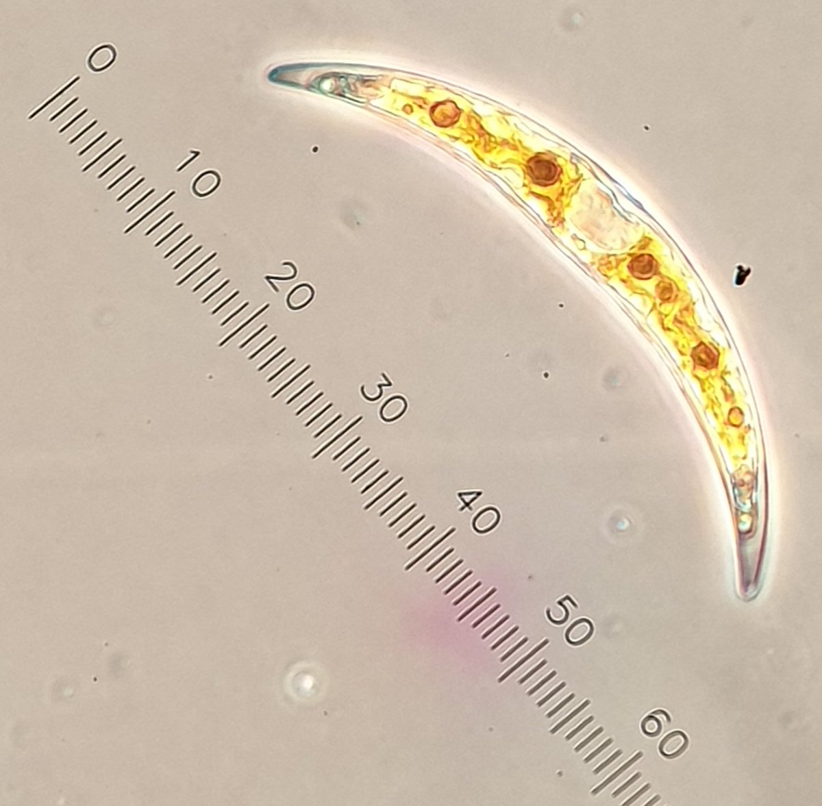 NotAPrimeNumber's tweet photo. Final picture from the green algae (#chlorophytes), #Desmid Closterium.
Added photos from my collection of Closterium, as well as a couple other cute desmids. https://t.co/zNCPC3FAaf