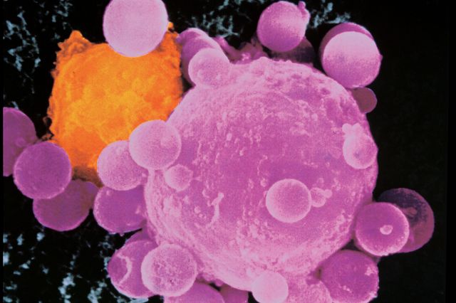 MOLECULARONCOL3's tweet photo. 🧬 Exploring the endless potential of #Bioinformatics in #Oncology! From deciphering genetic mutations to personalized treatment plans, this field is revolutionizing cancer research and patient care. 🌟 #CancerResearch #PrecisionMedicine #DataScience https://t.co/t3ROg5jeOn