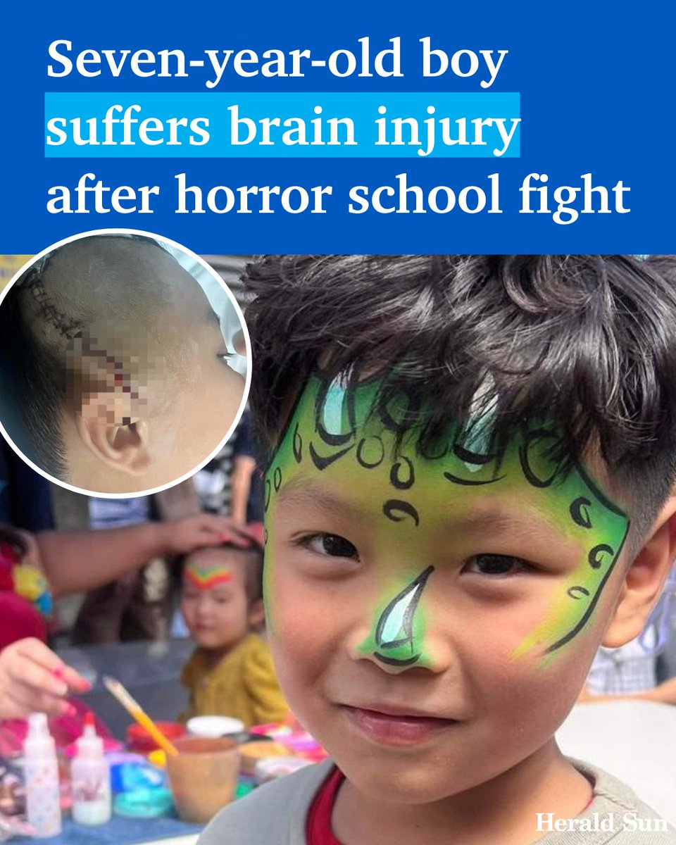theheraldsun's tweet photo. A year 1 student is in intensive care after he was allegedly bashed in a schoolyard fight in Mulgrave that left him with a brain haemorrhage and broken teeth. Full story: https://t.co/mBkwUjA2pG https://t.co/OGhzijSdBG