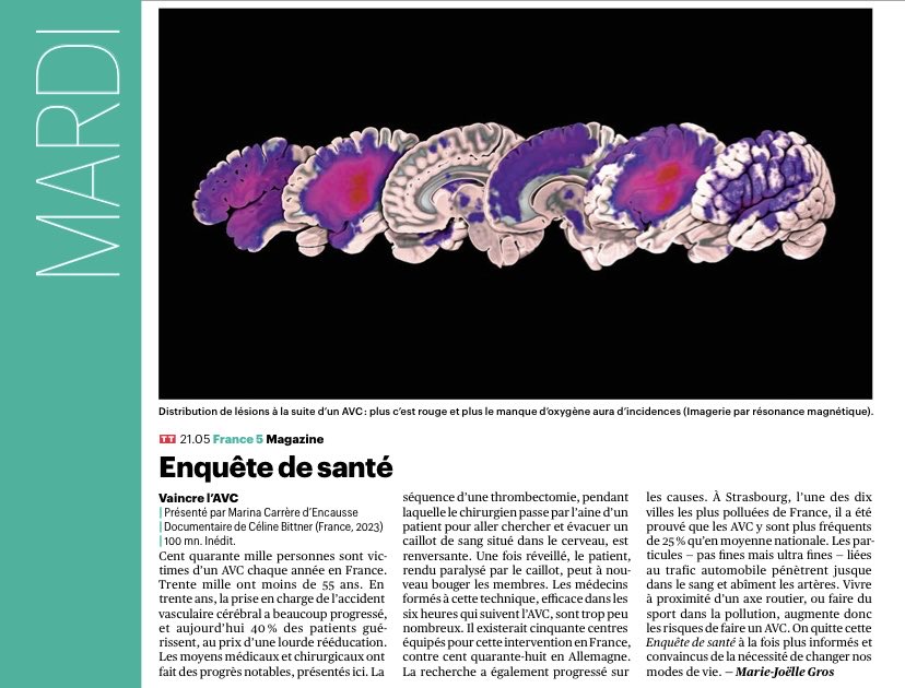 Merci ⁦<a href="/Telerama/">Télérama</a>⁩ ! mardi 7 novembre ne ratez pas Enquête de santé sur l’AVC <a href="/france5/">France cinq</a> ⁦<a href="/francetvpro/">France TV Pro</a>⁩ Longtemps considéré comme une fatalité, les médecins réussissent à vaincre l’AVC. Suivi d’un débat ⁦<a href="/mcdencausse/">carrere marina</a>⁩