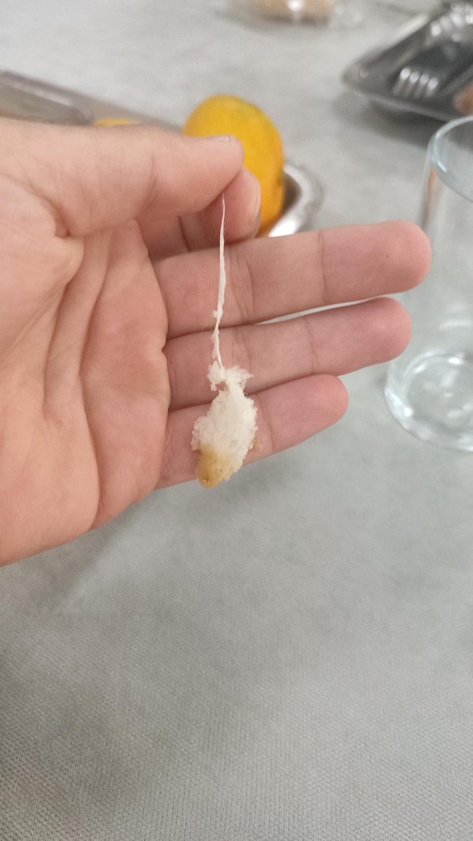 Gaün şaşırtmıyor 
Takipçimizden gelen fotoğraf ekmeğin içinden ip çıkmış