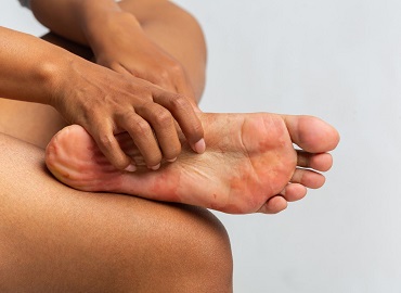 StayCured's tweet photo. Diabetic Foot: Charting the Course of the Effect on Feet https://t.co/YJGVqgaurZ #Footulcers #Insulin #diabetesmellitus #neuropathy #gangrene #Edema #osteomyelitis #ischemia #overweight #StayCured https://t.co/ZaQiAUow9S