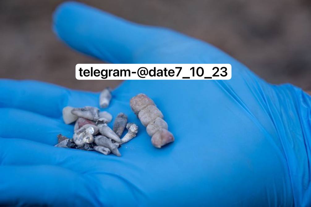 Where are the children of Kibbutz Bari?

A photo that illustrates all of the murdered teeth collected by Zakah volunteers at Kibbutz Bari.