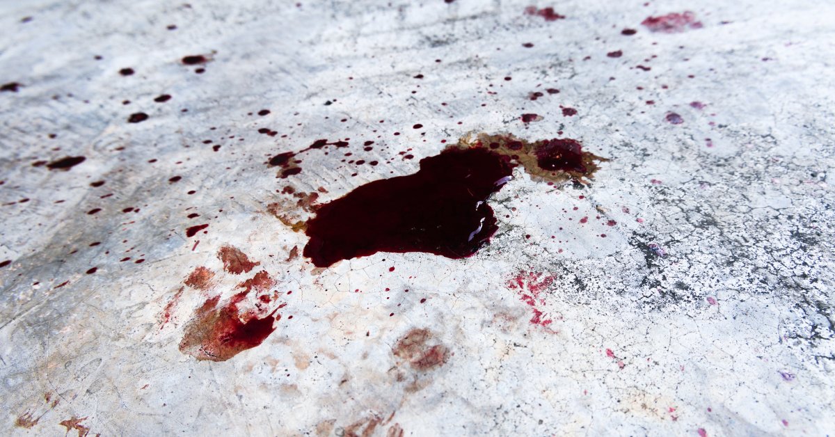 ForensicAccess's tweet image. Would you like to join our next #bloodpattern analysis awareness for scenes course?

This course offers a general understanding of #bloodpattern analysis to #undergraduate and #postgraduate students.

Contact us: ow.ly/TJVC50NPaWp

#forensicscientists