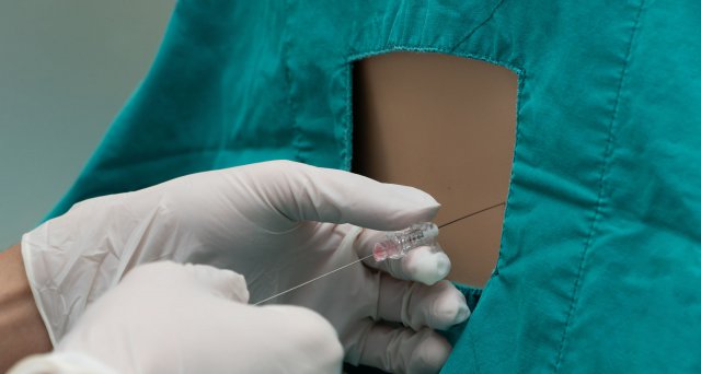 Neue Leitlinie zum Liquorunterdrucksyndrom:  Berlin – Die Deutsche Gesellschaft für Neurologie (DGN) hat eine Leitlinie „Diagnostik und Therapie des postpunktionellen und spontanen Liquorunterdrucksyndroms“ vorgestellt. Als… dlvr.it/SyFSR8 #DGN #Leitlinie
