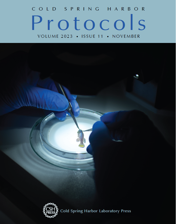 aemonten's tweet photo. A new issue of CSH Protocols is out!  

The cover image features the work of Vanhunsel, @StevenBergmans &amp; @LabMoons (@KU_Leuven), who describe a paradigm to induce and study both de- and regeneration of retinal ganglion cells and their axons in killifish. Links below! ⬇️ https://t.co/zE9vuBsbaB
