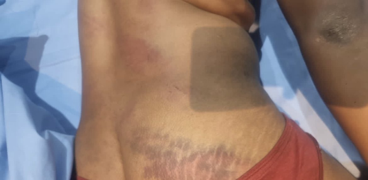 Fadzayi Mahere🇿🇼 (@advocatemahere) on Twitter photo 🟡TORTURE is a crime against humanity. What happened to Taku <a href="/ngadziore/">Takudzwa Ngadziore</a> is vile and despicable. If <a href="/PoliceZimbabwe/">Zimbabwe Republic Police</a> don’t act, the public can safely say they are complicit in this violent, criminal political persecution. #JusticeForTaku 🟡TORTURE is a crime against humanity. What happened to Taku <a href="/ngadziore/">Takudzwa Ngadziore</a> is vile and despicable. If <a href="/PoliceZimbabwe/">Zimbabwe Republic Police</a> don’t act, the public can safely say they are complicit in this violent, criminal political persecution. #JusticeForTaku