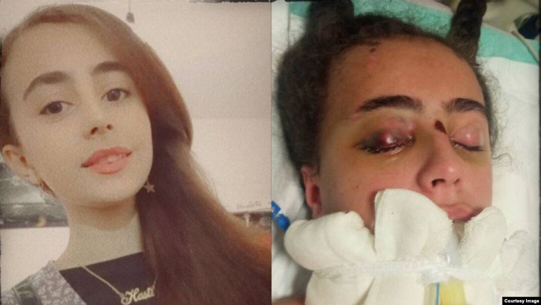 به #هستی_حسین‌پناهی ۱۵ ساله فقط به جرم پخش‌کردن تراکت چنان هجوم میارن که بعد از یک سال درگیری با کما هنوز قدرت تکلم و راه‌ رفتن‌اش رو بطور کامل به دست نیاورده.
هستی میتونست به سرنوشت آرمیتا و سارینا دچار بشه. جمهوری‌اسلامی شور، شوق و زندگی رو از دختر پسرهای این سرزمین میگیره.